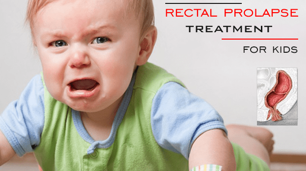 Herbal rectal prolapse treatment for kids