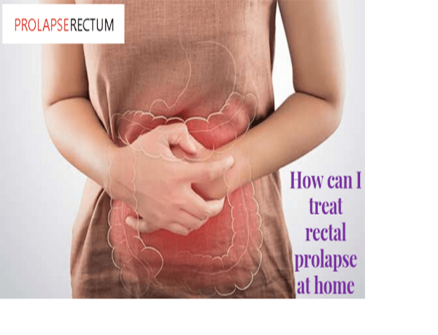 how-can-i-treat-rectal-prolapse-at-home