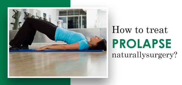 How To Treat Prolapse Naturally