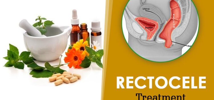 Rectocele Treatment