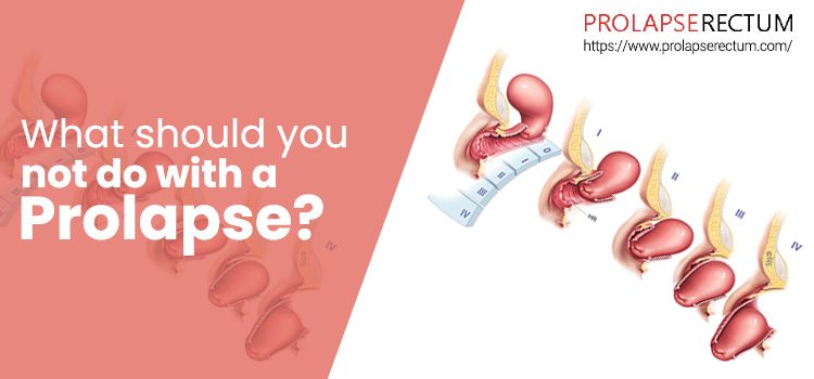 What Should You Not Do With A Prolapse