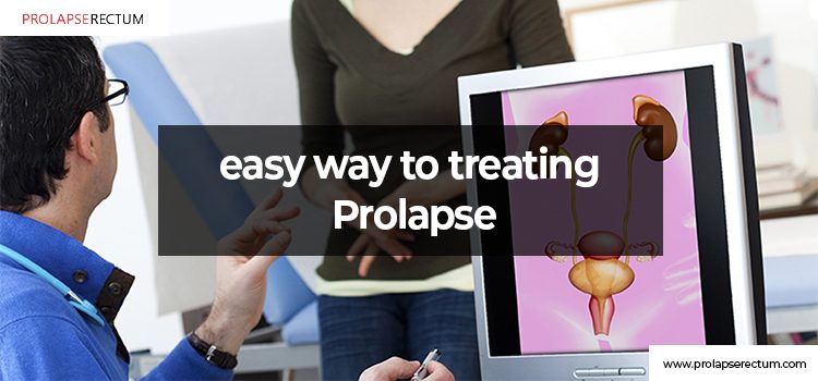 What Is An Easy Way To Treat Prolapse