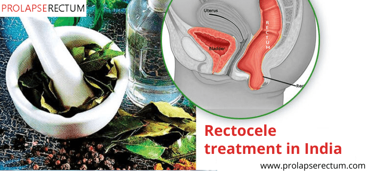 Rectocele Treatment In India