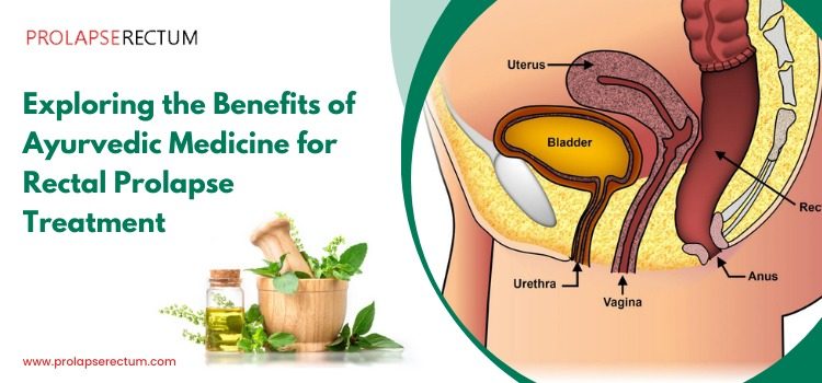 Exploring the Benefits of Ayurvedic Medicine for Rectal Prolapse Treatment