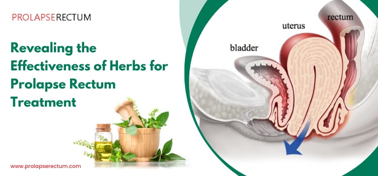 Revealing the Effectiveness of Herbs for Prolapse Rectum Treatment