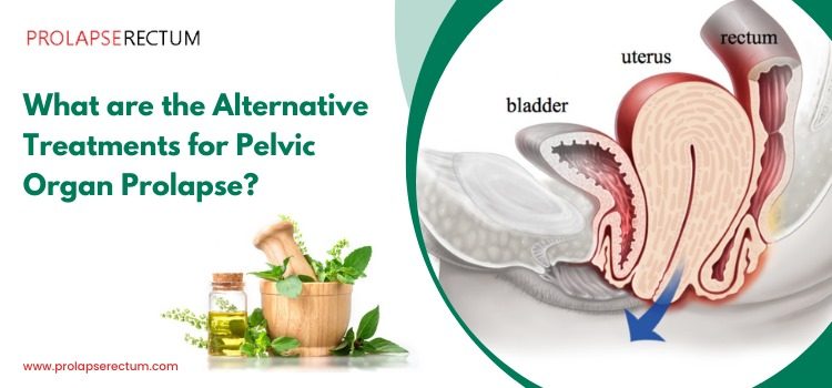 What are the Alternative Treatments for Pelvic Organ Prolapse?