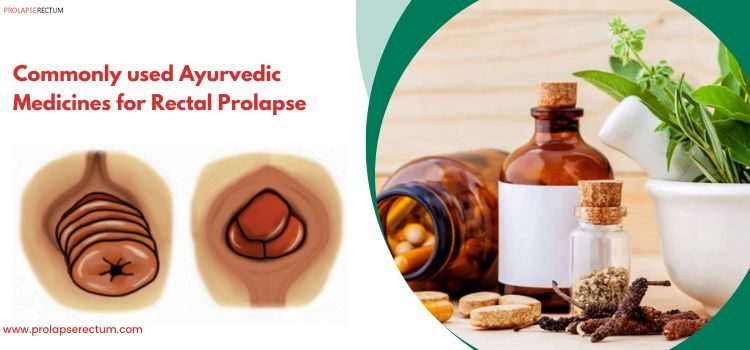 Commonly Used Ayurvedic Medicines for Rectal Prolapse
