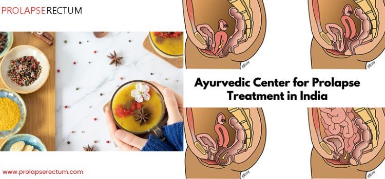 Ayurvedic Centers for Prolapse Treatment in India