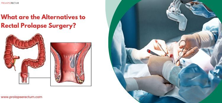 What Are the Alternatives to Rectal Prolapse Surgery?