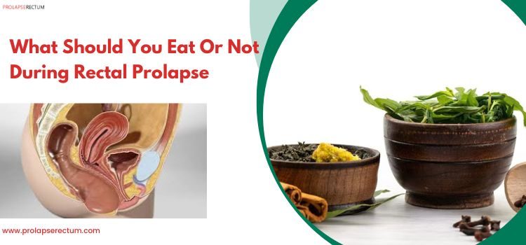 What Should You Eat Or Not During Rectal Prolapse?