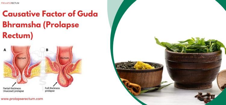 Causative Factor of Guda Bhramsha (Prolapse Rectum)